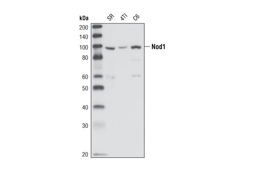 Western blot analysis of extracts from SR (human), 4T1 (mouse) and C6 (rat) cell lines using Nod1 Antibody.