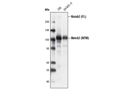 Western blot analysis of extracts from 293 and SK-MEL-5 cells using Notch2 (D76A6) XP ® Rabbit mAb. The full-length (FL) Notch2 protein and the transmembrane/intracellular region (NTM) are indicated.