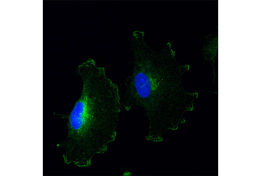Confocal immunofluorescent analysis of SNB19 cells using Notch2 (D76A6) XP ® Rabbit mAb (green). Blue pseudocolor = DRAQ5 ® #4084 (fluorescent DNA dye).