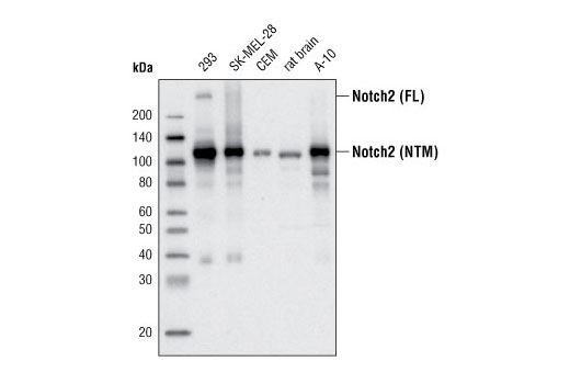 Western blot analysis of extracts from various cell lines using Notch2 (D67C8) XP ® Rabbit mAb. The full-length (FL) Notch2 protein and the transmembrane/intracellular region (NTM) are indicated.