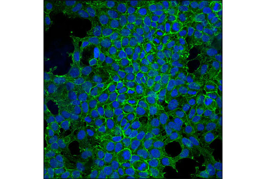 Confocal immunofluorescent analysis of 293 cells using Notch2 (D67C8) XP ® Rabbit mAb (green). Blue pseudocolor = DRAQ5 ® #4084 (Fluorescent DNA dye).