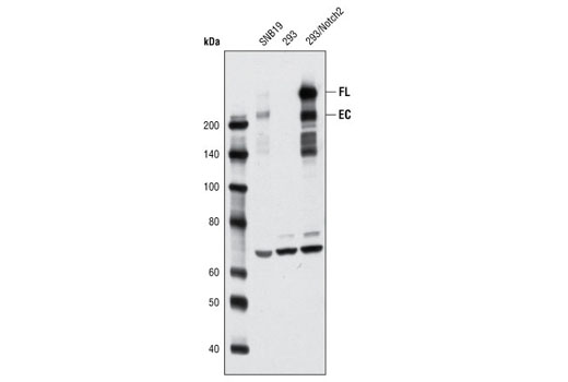Western blot analysis of extracts from SNB19 and 293 cells, untreated or stably expressing human Notch2, using Notch2 (8A1) Rabbit mAb. The full-length (FL) and the extracellular domain (EC) of Notch2 are indicated.