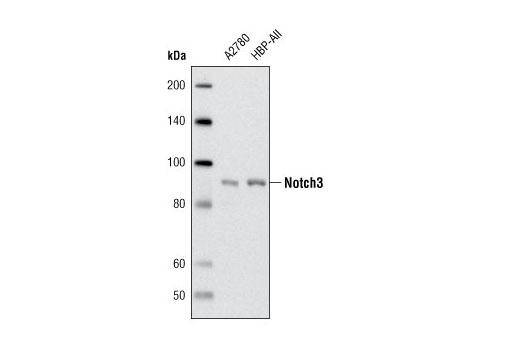 Western blot analysis of extracts from A2780 and HBP-ALL cells using Notch3 Antibody.