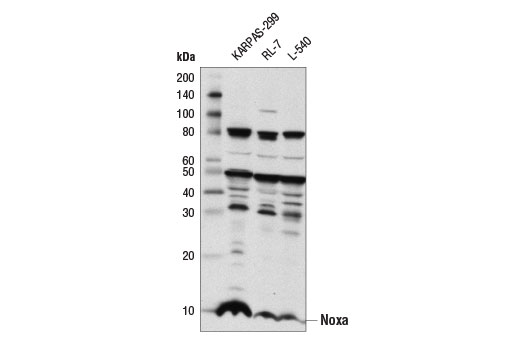 Western blot analysis of extracts from KARPAS-299, RL-7, and L-540 cells lines using Noxa (D8L7U) Rabbit mAb. Cell Line Source: Dr. Abraham Karpas at the University of Cambridge.