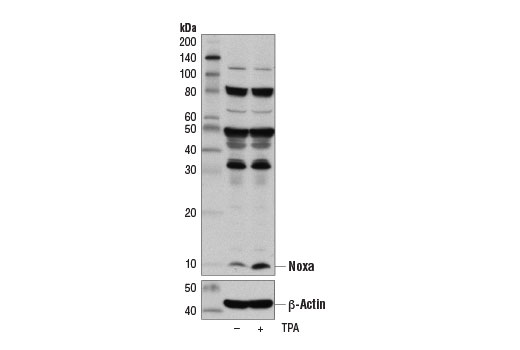 Western blot analysis of extracts from serum starved Jurkat cells, untreated (-) or treated with TPA #4174 (10 ng/ml, 3 hr; +), using Noxa (D8L7U) Rabbit mAb (upper) and β-Actin (D6A8) Rabbit mAb #8457 (lower).