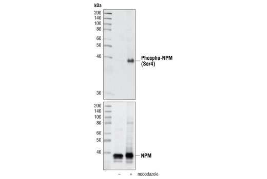 Western blot analysis of extracts of HeLa cells, either untreated or nocodazole-treated, using Phospho-NPM (Ser4) (D19C1) XP ® Rabbit mAb (upper). Lower panel shows total NPM using NPM Antibody #3542.
