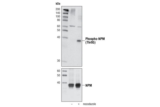 Western blot analysis of extracts of HeLa cells, untreated or nocodazole-treated, using Phospho-NPM (Thr95) Antibody (upper) or NPM Antibody #3542 (lower).