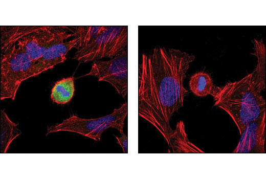 Confocal immunofluorescent analysis of HeLa cells untreated (left) and λ phosphatase-treated (right), using NPM (Thr95) phosphate Antibody (green). Actin filaments have been labeled using DY-554 phalloidin (red). Blue pseudocolor = DRAQ5™ (fluorescent DNA dye).