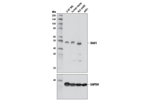 Western blot analysis of extracts from U-87 MG, NCI-H460, A431 cells, and human testis using DAX1 (D2F1) Rabbit mAb. A431 extract is negative as expected.