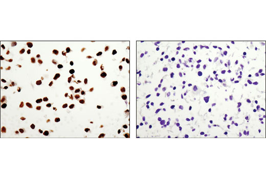 Immunohistochemical analysis of paraffin-embedded NCI-H460 (positive; left) or A431 (negative; right) cell pellets using DAX1 (D2F1) Rabbit mAb.