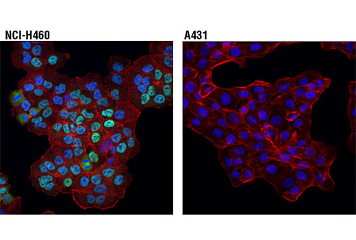 Confocal immunofluorescent analysis of NCI-H460 (positive; upper) and A431 (negative; lower) cells, using DAX1 (D2F1) Rabbit mAb (green). Actin filaments were labeled with DyLight™ 554 Phalloidin #13054 (red). Blue pseudocolor = DRAQ5 ® #4084 (fluorescent DNA dye).