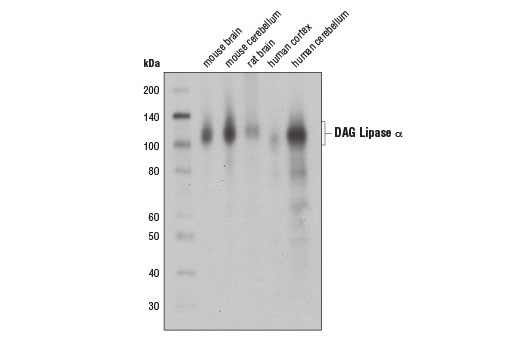 Western blot analysis of extracts from various tissues using DAG Lipase α (D3G8H) Rabbit mAb.
