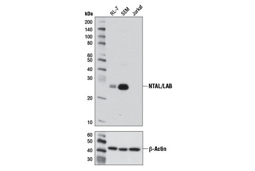 Western blot analysis of extracts from RL-7, SEM, and Jurkat cells using NTAL/LAB (D7I2B) Rabbit mAb (upper) or β-Actin (D6A8) Rabbit mAb #8457 (lower).