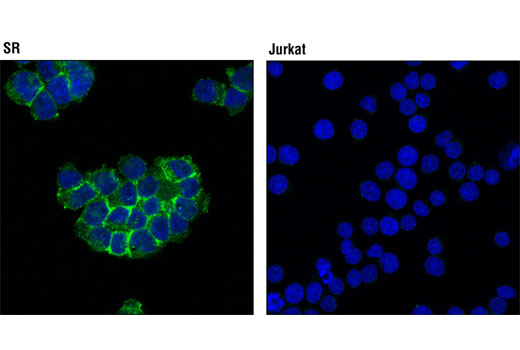 Confocal immunofluorescent analysis of SR (positive; left) and Jurkat (negative; right) cells using NTAL/LAB (D7I2B) Rabbit mAb (green). Blue pseudocolor = DRAQ5 ® #4084 (fluorescent DNA dye).