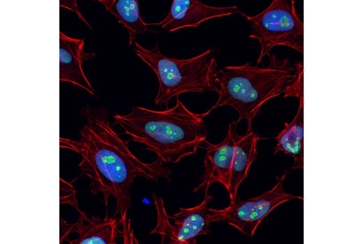 Confocal immunofluorescent analysis of HeLa cells using Nucleolin (D4C7O) Rabbit mAb (green). Actin filaments were labeled with DyLight™ 554 Phalloidin #13054 (red). Blue pseudocolor = DRAQ5 ® #4084 (fluorescent DNA dye).