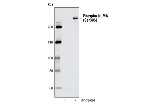Western blot analysis of extracts from M059K cells, untreated or UV-treated, using Phospho-NuMA (Ser395) Antibody.