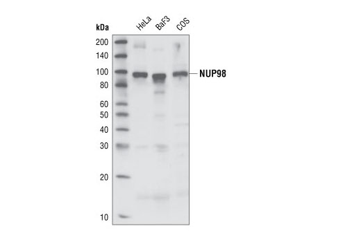 Western blot analysis of cell extracts from various cell types NUP98 (C37G10) Rabbit mAb.