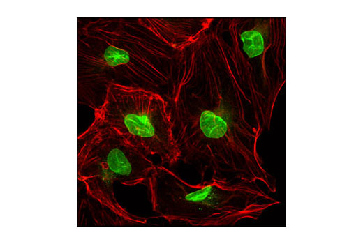 Confocal immunofluorescent analysis of Caki-1 cells using NUP98 (C39A3) Rabbit mAb (green). Actin filaments have been labeled with Alexa Fluor ® 555 phalloidin (red).