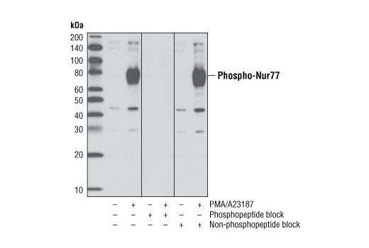 Western blot analysis of extracts from Jurkat cells, untreated or treated with TPA #4174 and calcium ionophore A23187 for 4 hours, using Phospho-Nur77 (Ser351) (D22G5) Rabbit mAb. Antibody phospho-specificity was confirmed by pre-incubating the antibody with either a phosphorylated site-specific peptide to block the signal or a non-phosphorylated site-specific peptide that does not block the signal.