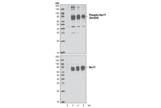 Western blot analysis of extracts from Jurkat cells, untreated or treated with TPA #4174 and calcium ionophore A23187 for the indicated times, using Phospho-Nur77 (Ser351) (D22G5) Rabbit mAb (upper) or Nur77 (D63C5) XP ® Rabbit mAb #3960 (lower).