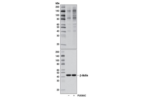 Western blot analysis of extracts from HeLa cells, untreated (-) or treated with PUGNAc (+), an inhibitor of N-acetyl-β-D-glucosaminidase, using O-GlcNAc (CTD110.6) Mouse mAb (upper) or β-Actin (13E5) Rabbit mAb #4970 (lower).