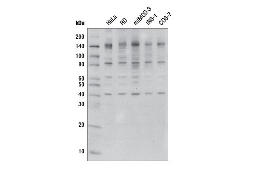 Western blot analysis of extracts from various cell lines using O-GlcNAc (CTD110.6) Mouse mAb.