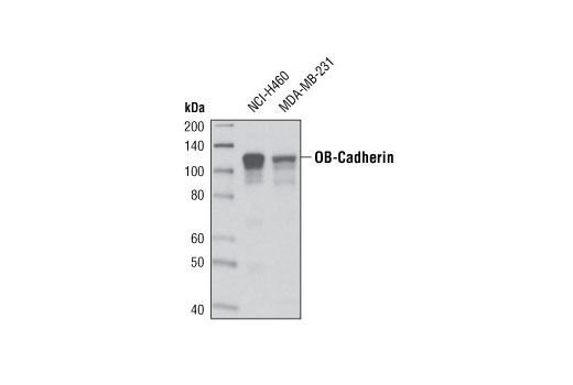 Western blot analysis of extracts from NCI-H460 and MDA-MB-231 cells using OB-Cadherin (P707) Antibody.