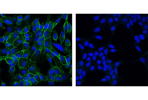 Confocal immunofluorescent analysis of PC-3 (positive, left) and LNCaP (negative, right) cells using OB-Cadherin (P707) Antibody (green). Blue pseudocolor = DRAQ5 ® #4084 (fluorescent DNA dye).