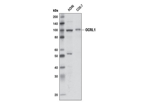 Western blot analysis of extracts from ACHN and COS-7 cells using OCRL1 Antibody.