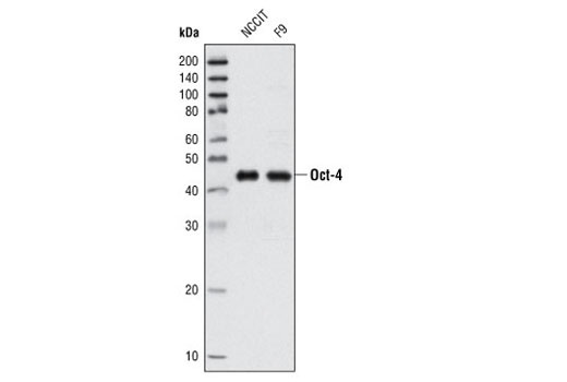 Western blot analysis of extracts from NCCIT and F9 cells using Oct-4 (V241) Antibody.
