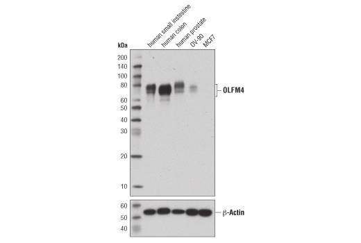 Western blot analysis of extracts from human small intestine, colon, and prostate, and two human cancer cell lines (OV-90 and MCF7), using OLFM4 (D1E4M) XP ® Rabbit mAb (upper) and β-actin (D6A8) Rabbit mAb #8457 (lower). As expected, OLFM4 protein expression is not detected in MCF7 cells.