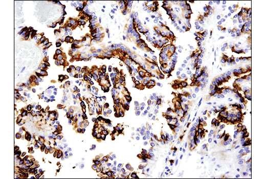 Immunohistochemical analysis of paraffin-embedded human ovarian serous cystadenoma using OLFM4 (D1E4M) XP ® Rabbit mAb.