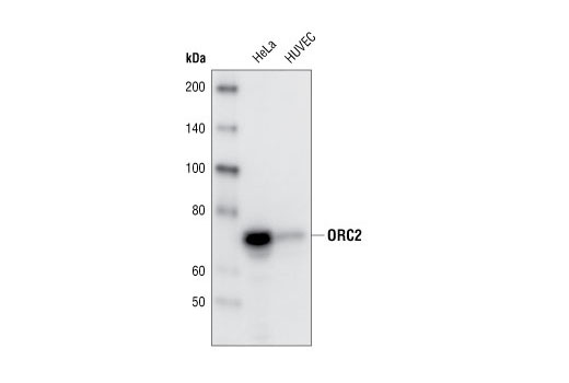 Western blot analysis of extracts from HeLa and HUVEC cells, using ORC2 (3G6) Rat mAb.
