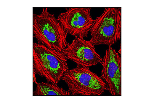 Confocal immunofluorescent analysis of HeLa cells using ORC2 (3G6) Rat mAb (blue) and COX IV (3E11) Rabbit mAb #4850 (green). Actin filaments have been labeled with DY-554 phalloidin (red).
