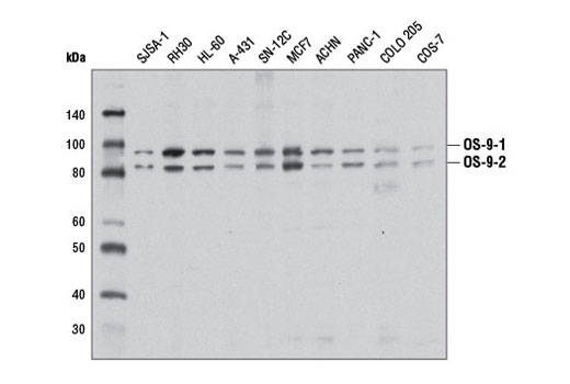 Western blot analysis of extracts from various cell lines using OS-9 (D8P4G) Rabbit mAb.