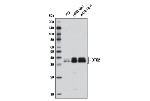 Western blot analysis of extracts from Y79, D283 Med, and WERI-Rb-1 cells using OTX2 (D7Y3J) Rabbit mAb.