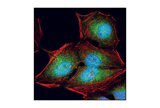 Confocal immunofluorescent analysis of HeLa cells using OSR1 Antibody (green). Actin filaments have been labeled with Alexa Fluor® 555 phalloidin (red). Blue pseudocolor = DRAQ5 ® #4084 (fluorescent DNA dye).