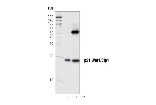 Immunoprecipitation of p21 from human umbillical vein endothelial cells (HUVECs) using p21 Waf1/Cip1 (12D1) Rabbit mAb. Western blot detection was performed using the same antibody.