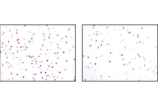 Immunohistochemical analysis of paraffin-embedded HeLa cells, transfected with SignalSilence ® Control siRNA (Unconjugated) #6568 (left) or SignalSilence ® p21 Waf1/Cip1 siRNA II #6558 (right), using p21 Waf1/Cip1 (12D1) Rabbit mAb.