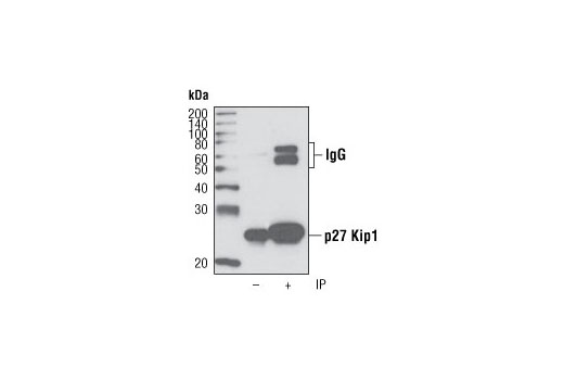 Immunoprecipitation of p27 Kip1 from NIH/3T3 cells using p27 Kip1 (D37H1) Rabbit mAb. Western blot analysis was performed using the same antibody. Lane 1 is 5% input.