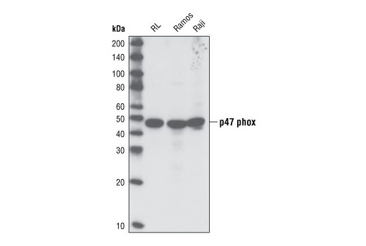 Western blot analysis of cell extracts from various cell types using p47phox Antibody.
