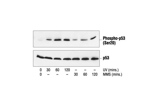 Western blot analysis of extracts from COS cells treated with UV or MMS for the indicated times, using Phospho-p53 (Ser20) Antibody (upper) or p53 Antibody #9282 (lower).