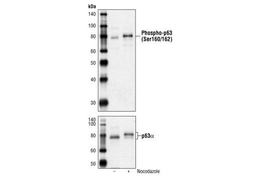 Western blot analysis of extracts from untreated or nocodazole-treated (50 ng/ml, 24 h) ME-180 cells using Phospho-p63 (Ser160/162) Antibody (upper) or p63alpha Antibody #4892 (lower).