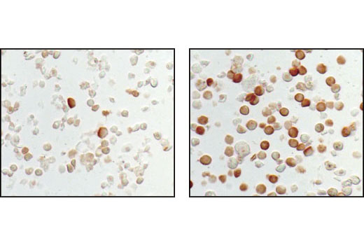 Immunohistochemical analysis of paraffin-embedded ME-180 cells, untreated (left) or nocodozole-treated (right), showing induced nuclear staining, using Phospho-p63 (Ser160/162) Antibody.