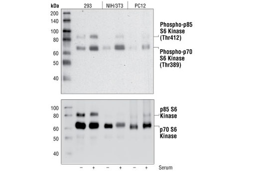Western blot analysis of extracts from serum starved or serum treated (20%) 293, NIH/3T3, and PC12 cells, using Phospho-p70 S6 Kinase (Thr389) (108D2) Rabbit mAb (upper), or p70 S6 Kinase (49D7) rabbit mAb #2708 (lower).