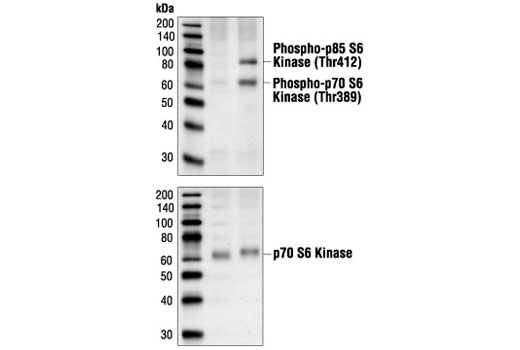Western blot analysis of extracts from NIH/3T3 cells, serum-starved or serum-treated (20%) using Phospho-p70 S6 Kinase (Thr389) (1A5) Mouse mAb (upper) and p70 S6 Kinase Antibody #9202 (lower).