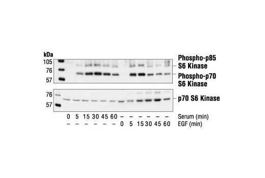 Western blot analysis of extracts from 293 cells, untreated, serum-treated or EGF-treated (100 ng/ml), using Phospho-p70 S6 Kinase (Thr421/Ser424) Antibody (upper) or p70 S6 Kinase Antibody #9202 (lower).