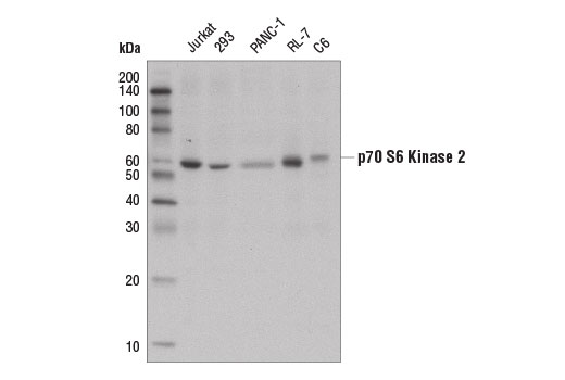 Western blot analysis of extracts from various cell lines using p70 S6 Kinase 2 Antibody.