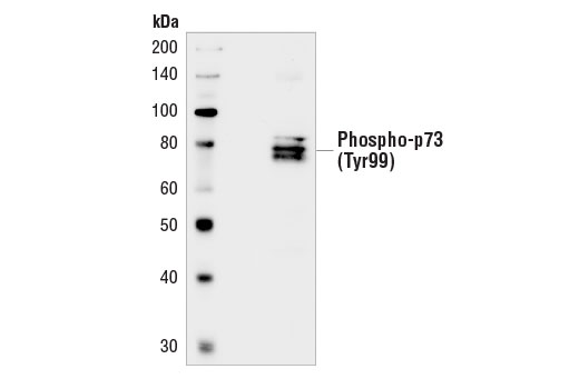 Western blot analysis of extracts from HT-1376 cells, untreated or pervanadate-treated ( 1 mM, 20 minutes), using Phospho-p73 (Tyr99) Antibody.