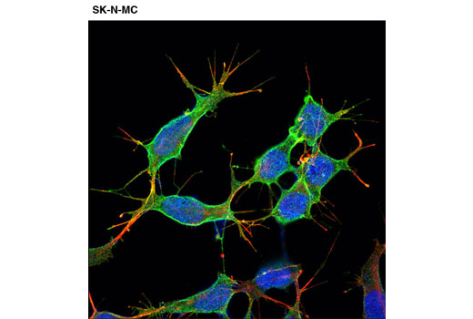 Confocal immunofluorescent analysis of SK-N-MC cells using p75NTR (D4B3) XP ® Rabbit mAb (green). Actin filaments were labeled with DY-554 phalloidin (red). Blue pseudocolor = DRAQ5 ® #4084 (fluorescent DNA dye).